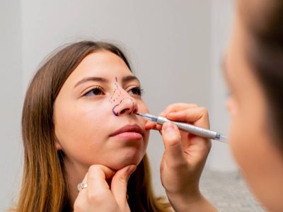 close-up plastic surgeon makes marks on a patient's face during a consultation before nose operation