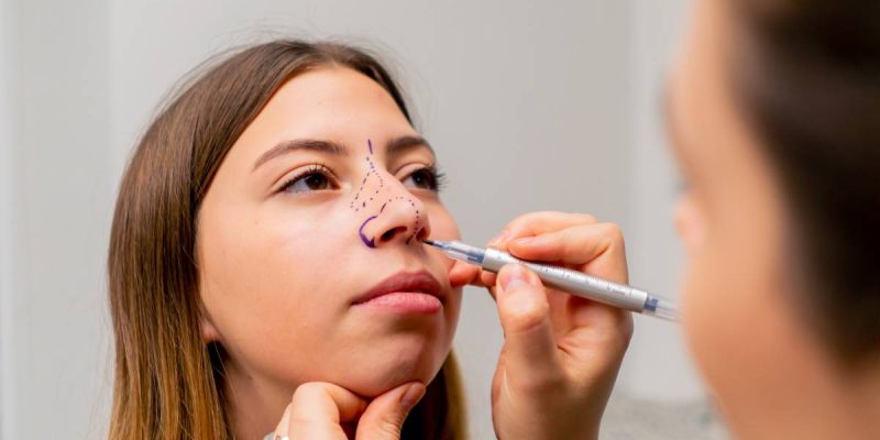 close-up plastic surgeon makes marks on a patient's face during a consultation before nose operation