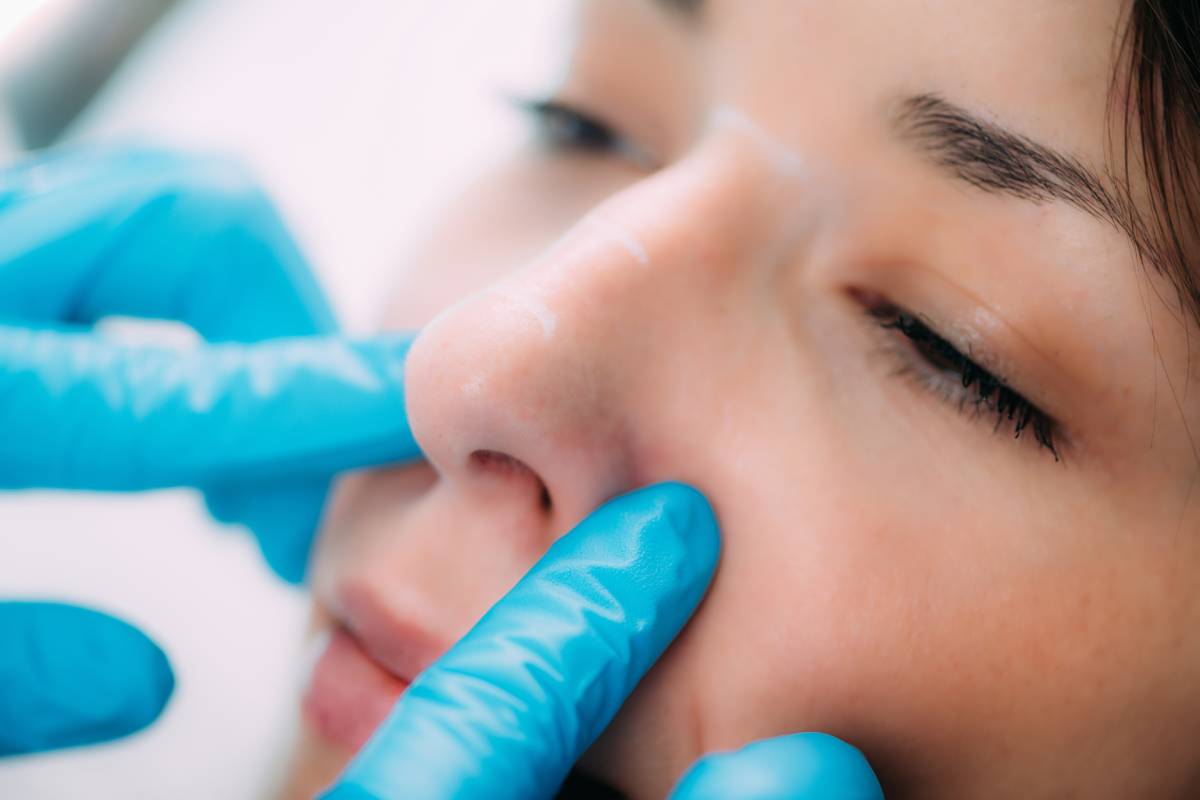 Doctor preparing a dermal filler for treatment of a womans nose.